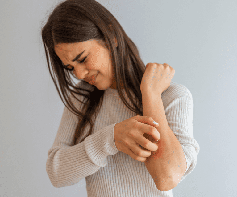 Dermatites e Alergias de Pele