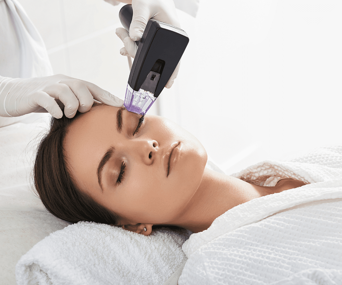 Radiofrequência Monopolar