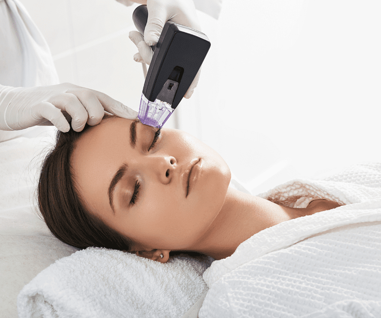 Radiofrequência Monopolar