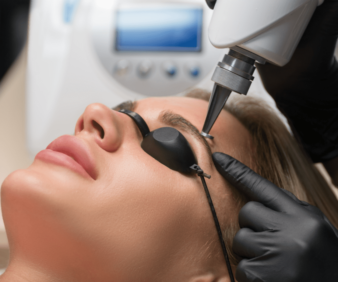 Laser de Picossegundos