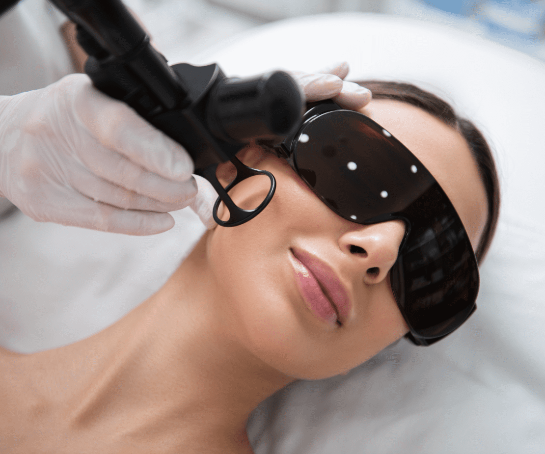 Laser Fracionado Ablativo Erbium